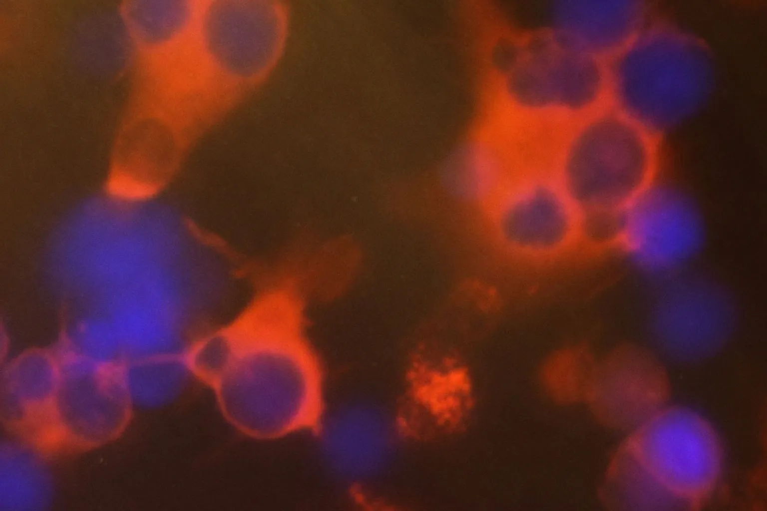 A renewable cell source for cancer immunotherapy could make off-the-shelf treatments possible